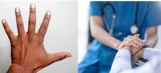 Lesioni e riabilitazione della mano (I) Comunicazione e implicazioni in campo professionale (II)